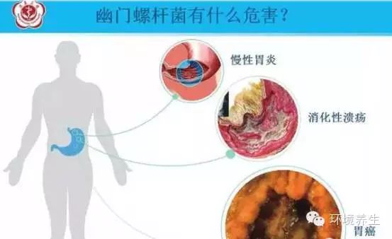 病菌最新动态，无声战役背后的背景与影响